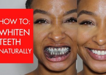 how to whiten carpet