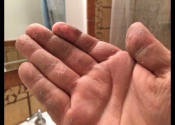how to get polyurethane off hands