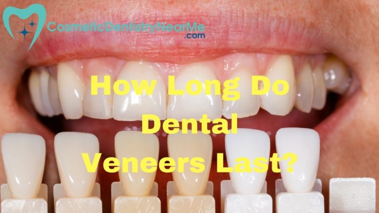 How long do ballasts last?