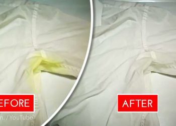 how to get rid of yellow stains on white clothes