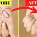 how to remove permanent marker from skin fast